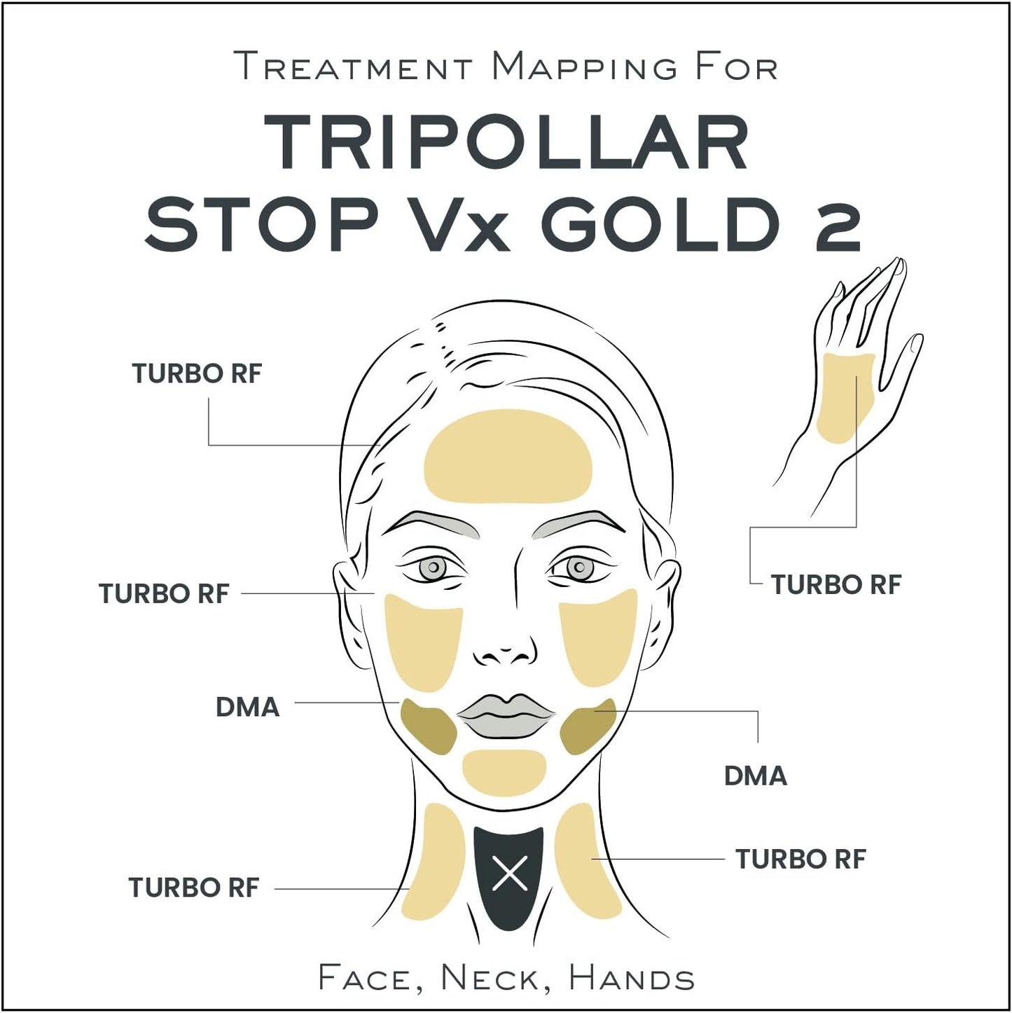 Tripollar Stop Vx Gold2 - Radio Frequency Skin Tightening Machine Face and Neck - at Home Rf Anti-Aging Device Lifting Toning Wrinkle Removal Device - Radiofrecuencia Facial Machine