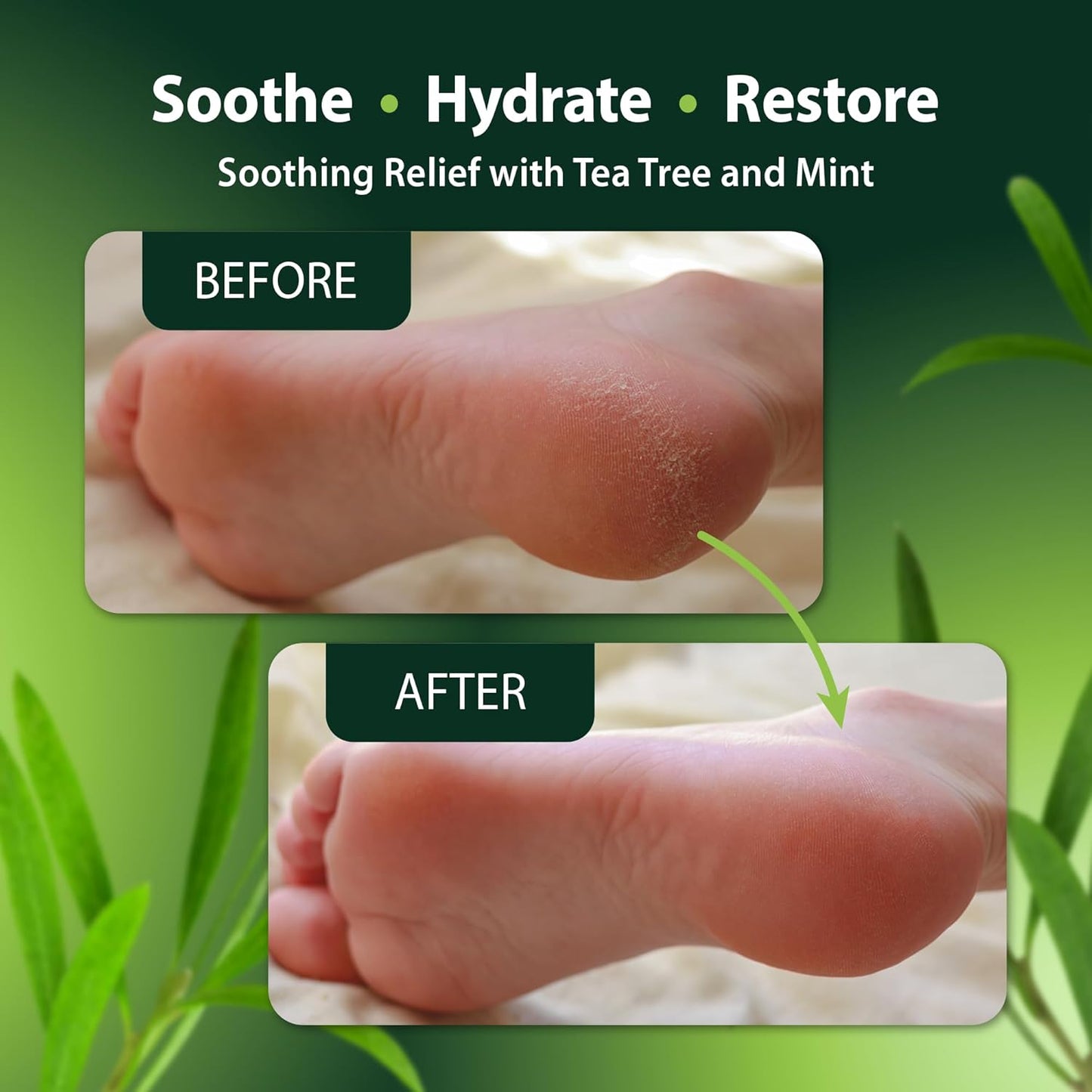 Foot and Body Oil with Tea Tree Oil - Hydrating Foot Care and Foot Spa for Cracked Heel Repair - Soothes Dry, Irritated Skin and Foot Odor - (4oz)