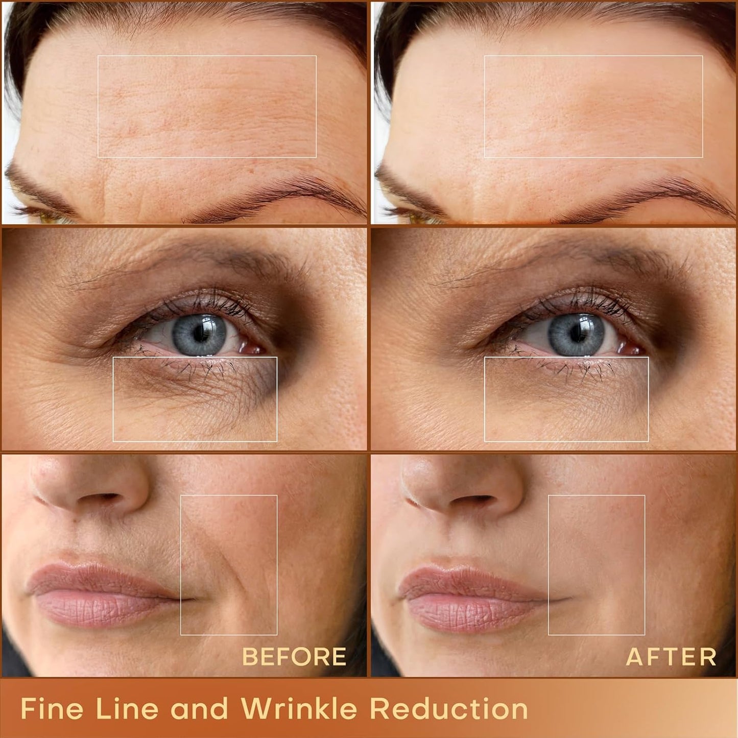 MLAY Professional RF Beauty Machine, Radio Frequency Face Machine with 2 Probes, at Home Radio Frequency Skin Tightening for Lifting, Wrinkle Reducing, Anti Aging - Salon Effects(Gel Included)