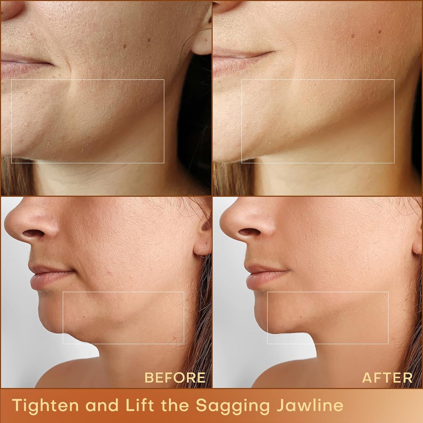 MLAY Professional RF Beauty Machine, Radio Frequency Face Machine with 2 Probes, at Home Radio Frequency Skin Tightening for Lifting, Wrinkle Reducing, Anti Aging - Salon Effects(Gel Included)