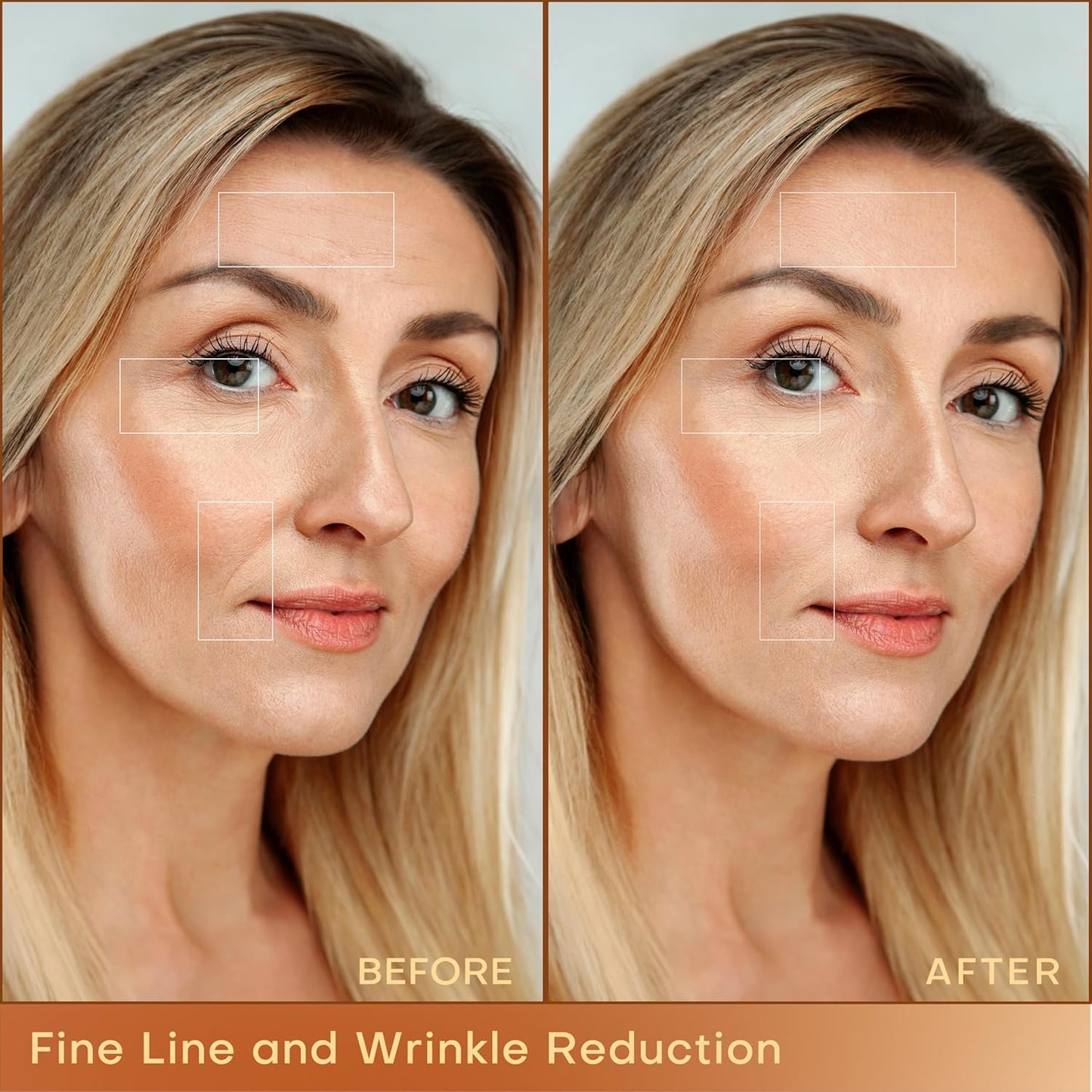 MLAY Professional RF Beauty Machine, Radio Frequency Face Machine with 2 Probes, at Home Radio Frequency Skin Tightening for Lifting, Wrinkle Reducing, Anti Aging - Salon Effects(Gel Included)