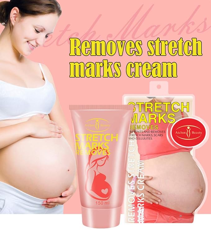 AICHUN BEAUTY Pregnancy Cream Streach Mark Remover Scars Repair Cellulites Lotion Cream 150ml