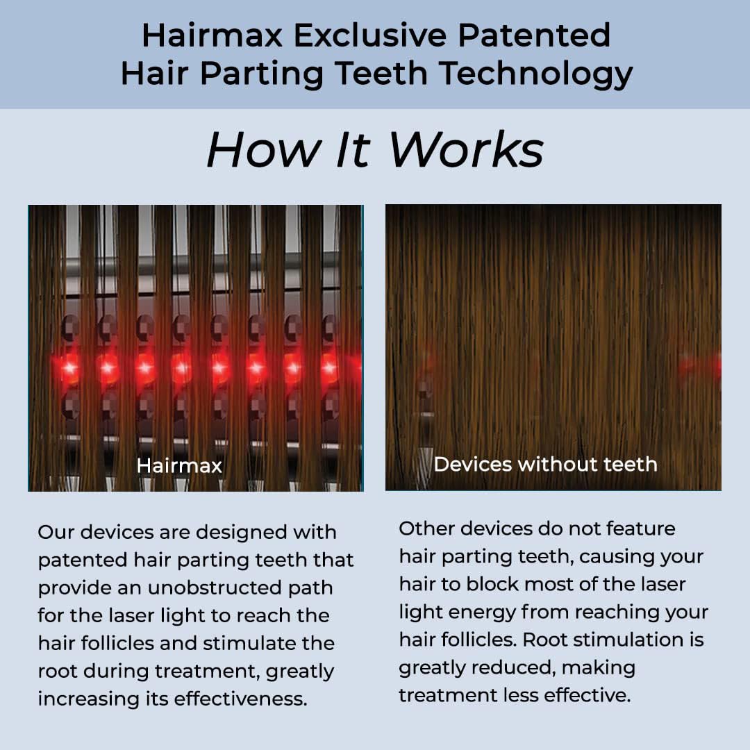 Hairmax Ultima 9 Classic LaserComb -(FDA Cleared) Laser Hair Regrowth Treatment Device for Men & Women - Reverses Thinning Hair Loss - Red Light Therapy to Stimulate Hair Growth - Cordless Design