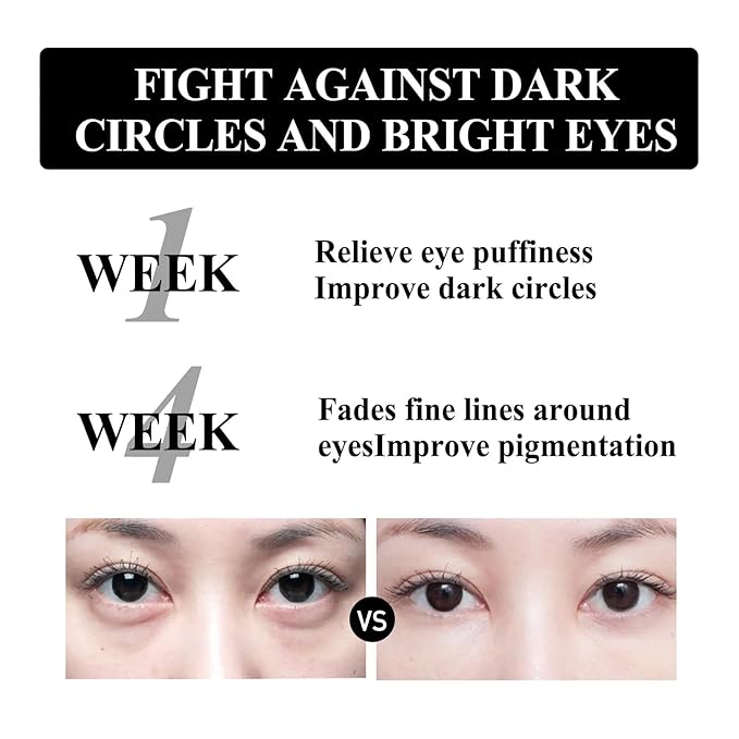 Retinol Snake Venom Peptide Eye Cream, Firming Eye Cream, Anti Ageing Eye Cream, Under Eye Cream For Puffiness and Bags Reduces Fine Lines