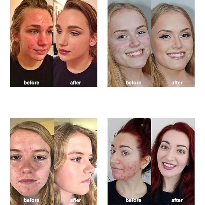 2 Pack PHOERA Foundation,Matte Oil Control Concealer Foundation Cream,PHOERA Long Lasting Waterproof Matte Liquid Foundation for Women Girls (102 Nude+103 Warm peach)