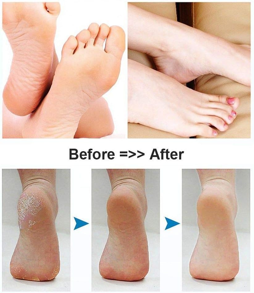 BOMPOW Electric Foot File Hard Skin Remover Pedicure Tools Electronic Callus kit for Cracked Heels and Dead Skin with 2 Roller Heads, Black