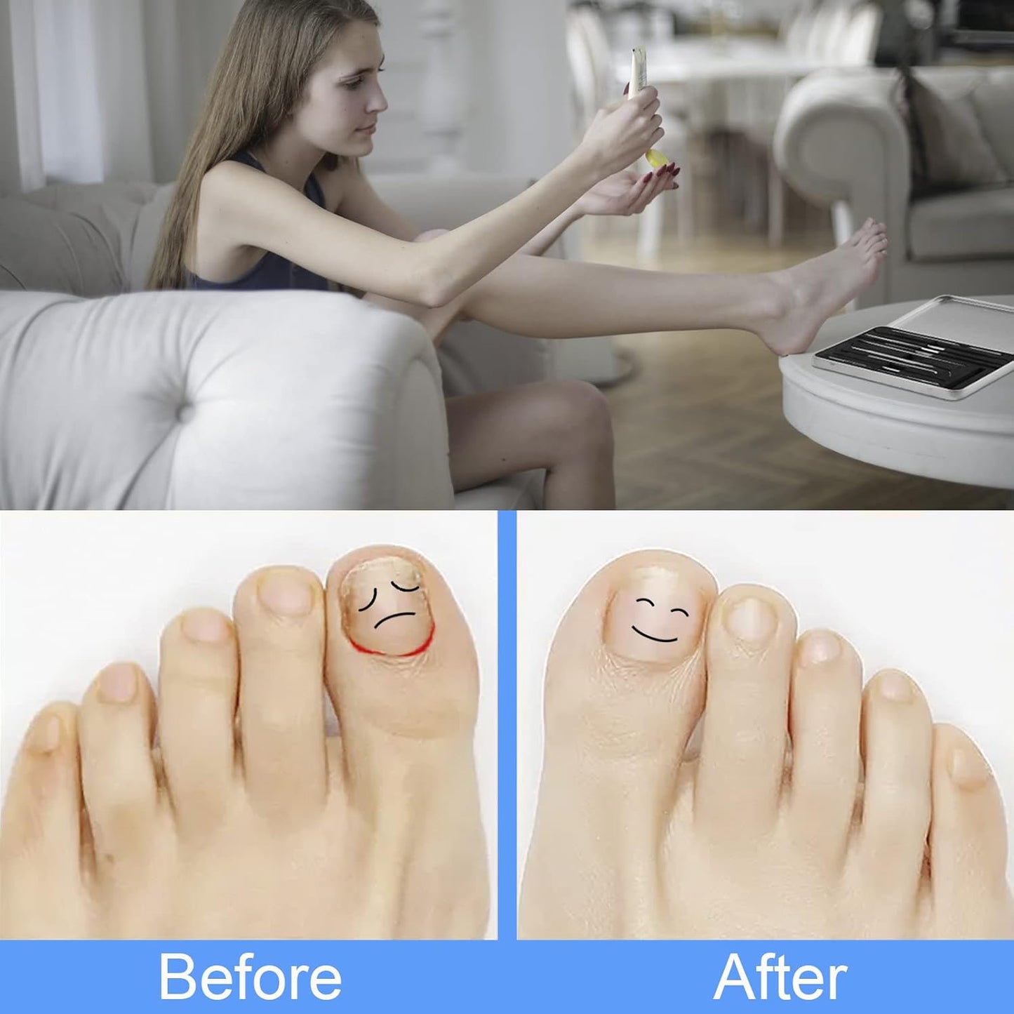 Ingrown Toenail Tool Removal Tool Kit, 10PCS Surgical Stainless Steel Professional Ingrown Toenail File and Lifters Manicure Care Treatment for Nail Correction Under Sidewall Clean