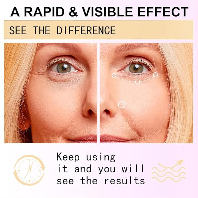 Snail Peptide Eye Cream for Dark Circles, Puffiness and Wrinkle, Snail Mucin & Nicotinamide, Moisturizing, Hydrating, Firming, Massage Ball, 17ml