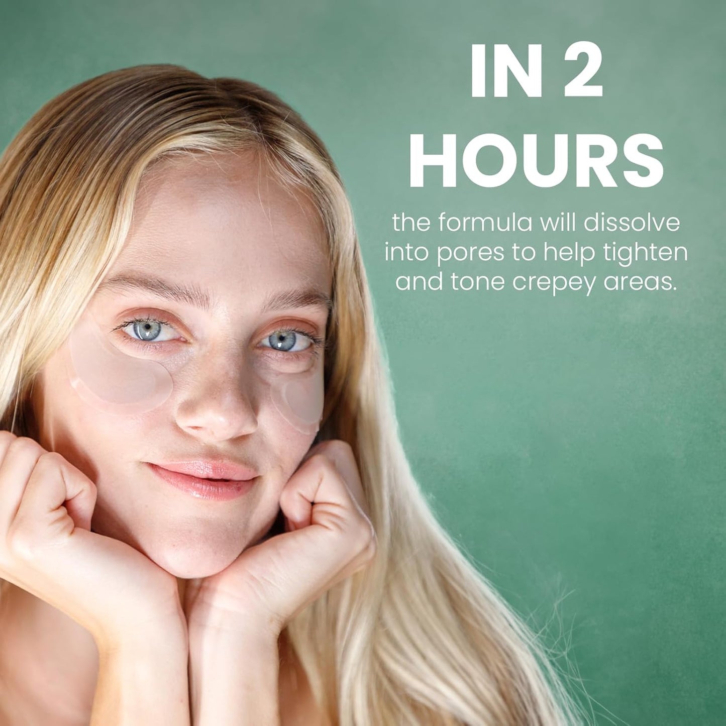 skyn ICELAND Dissolving Microneedle Under Eye Patches with 39% Hyaluronic Acid and Peptides, No Slip Overnight Eye Mask for Fine Lines, Wrinkles and Firming, Vegan, All Skin Types, 5 Pairs