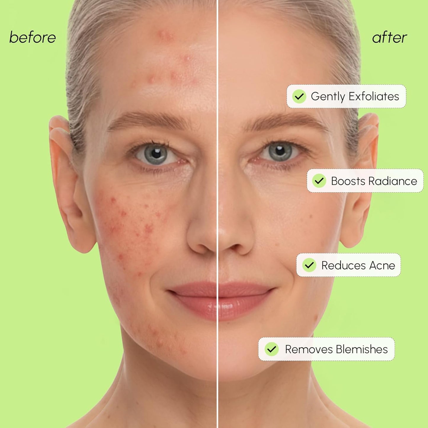 MAREE Exfoliating Toner with Salicylic Acid – AHA BHA Face Exfoliant & Pore Cleaner – BHA Liquid Exfoliant for Sebum & Dead Skin Care Remover – Face Exfoliator – Acido Salicilico Exfoliante Facial