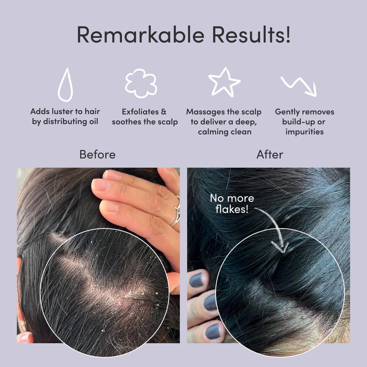 Jupiter Scalp Exfoliator - Scalp Massager Tool for Wet & Dry Hair - Ergonomic Detangler Brush - Dandruff Comb & Scrub to Remove Dandruff & Buildup and Support Circulation - White