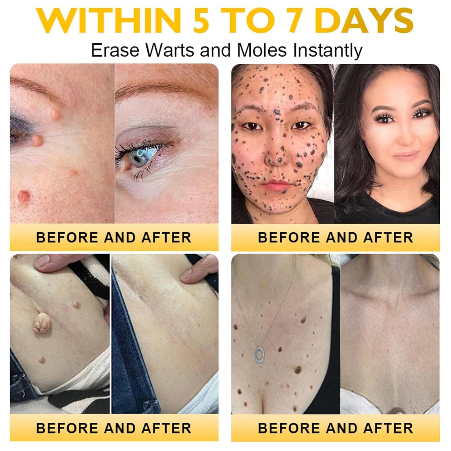 LipMaps Bee Venom skin Restoration Cream,Bee Venom Skin Treatment Cream,Deeply Moisturizing and Firming for All skin Types(2PCS)