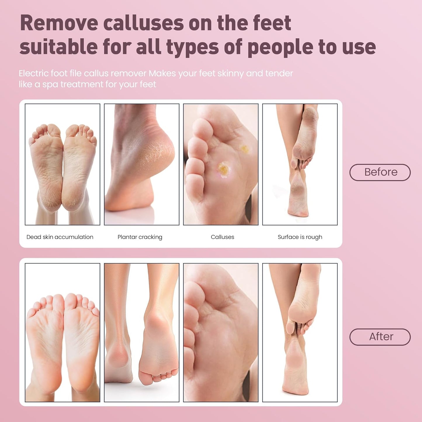 Electric Foot Callus Remover,2 in1 Rechargeable Callus Remover for Feet,9-Speed Wireless Electric Foot File Nail Grinder,Foot Scrubber Pedicure Tools for Dead Skin Dry Cracked Feet(Pink Fold)