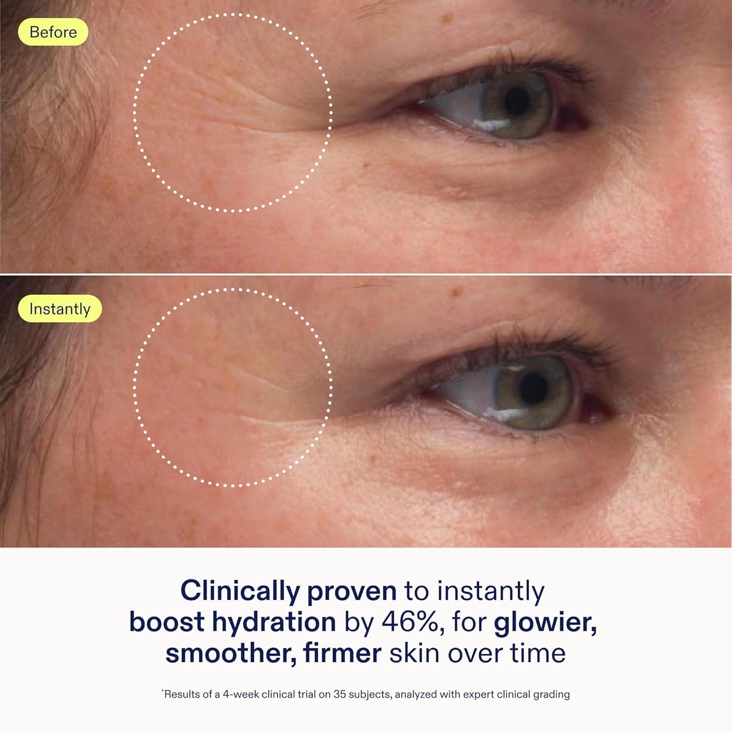 Skinfix Triple Lipid-Peptide Cream Refill - 1.7 oz - Rich Face Moisturizer to Instantly Hydrate & Restore Dry, Sensitive Skin - Non-Comedogenic, Fragrance Free, Vegan, Cruelty Free