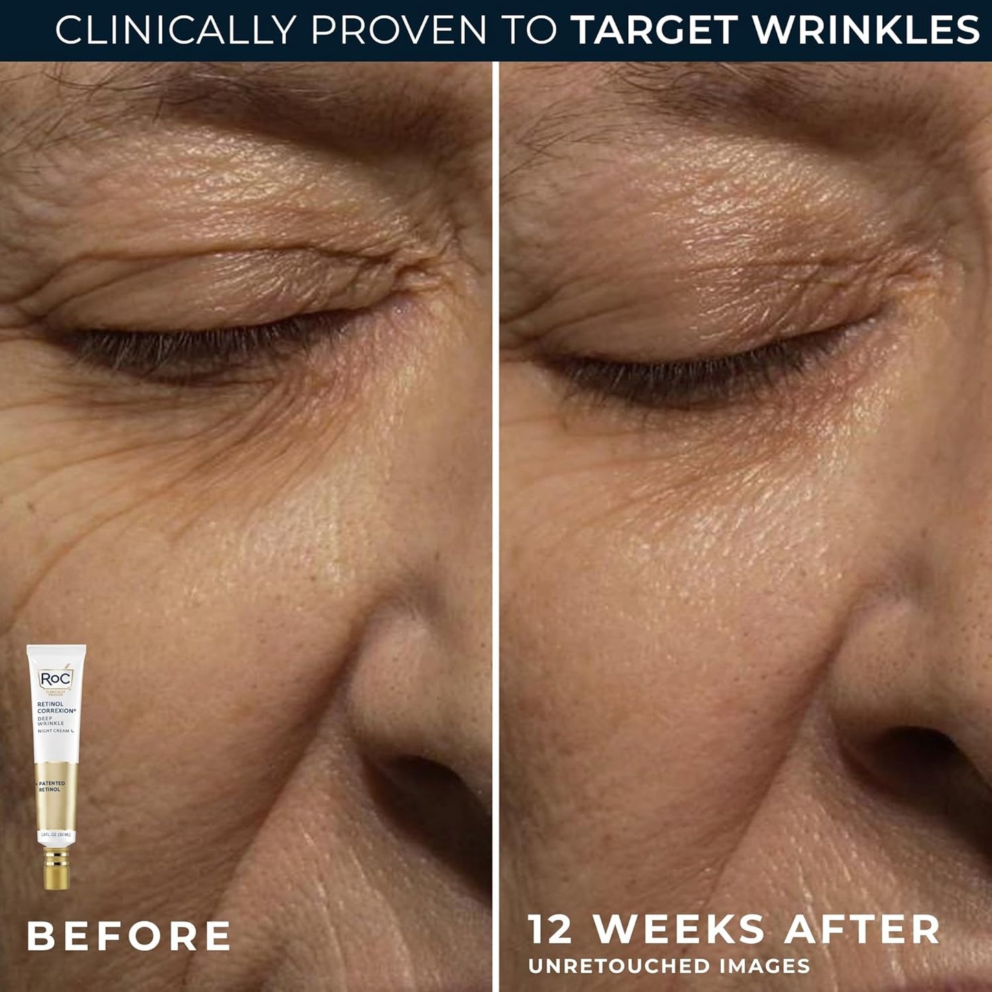 RoC Retinol Correxion Value Set Duo, Deep Wrinkle Anti-Aging Night Face Cream + Under Eye Cream for Dark Circles & Puffiness - Retinol Eye Care