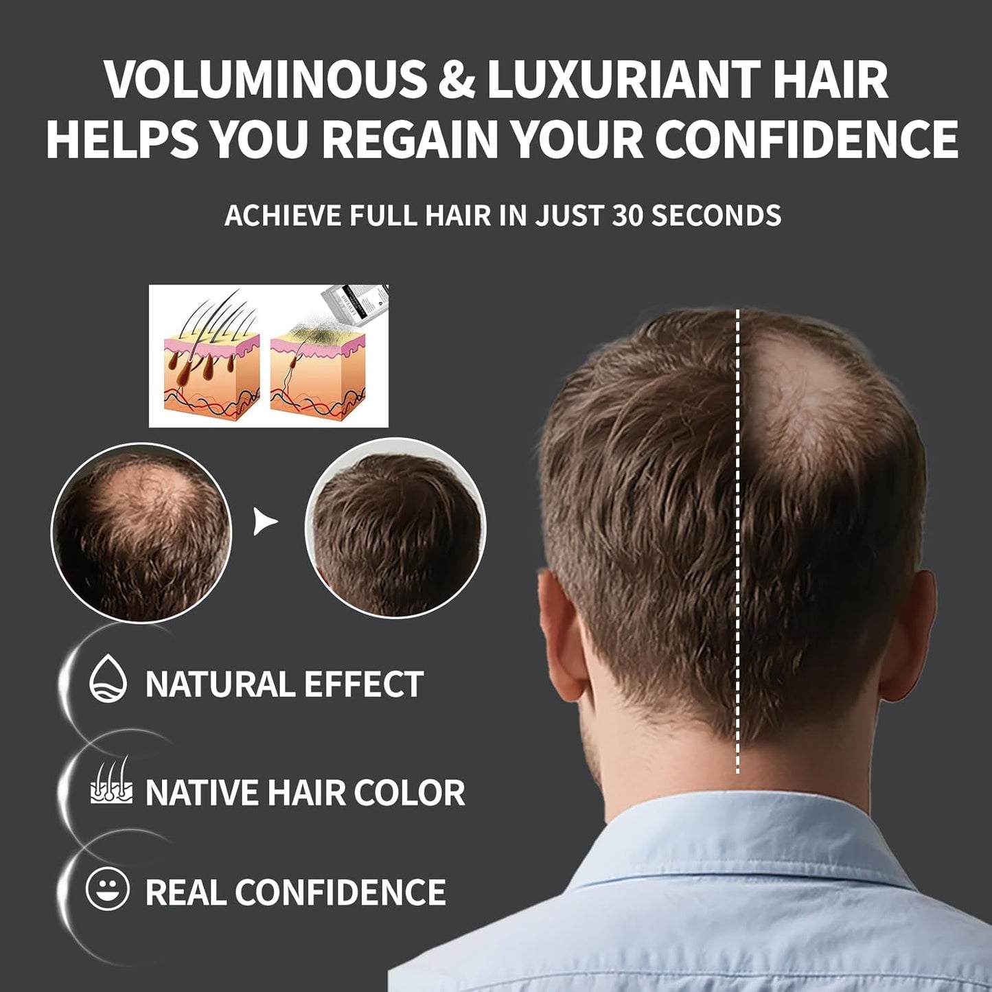 Hair Building Fibers Refill Pack - 100g Instant Thickening Fibers for Men & Women, Natural Cotton Powder, Wind/Rain Resistant, For All Hair Fiber Applicator Bottles (Dark brown)