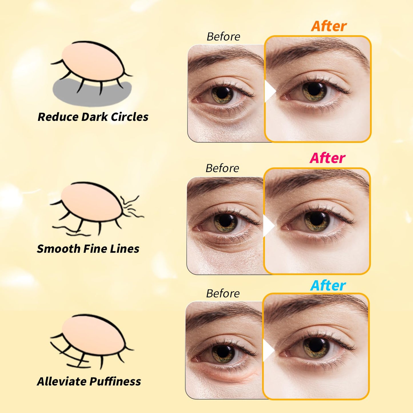 Under Eye Patches(24 Pairs), 24K Gold, Caffeine, Retinol Eye Masks for Puffy Eyes, Wrinkles, Dark Circles, Undereye Bags Treatment - Restoring & Awakening & Moisturizer Skin care Gift for Women