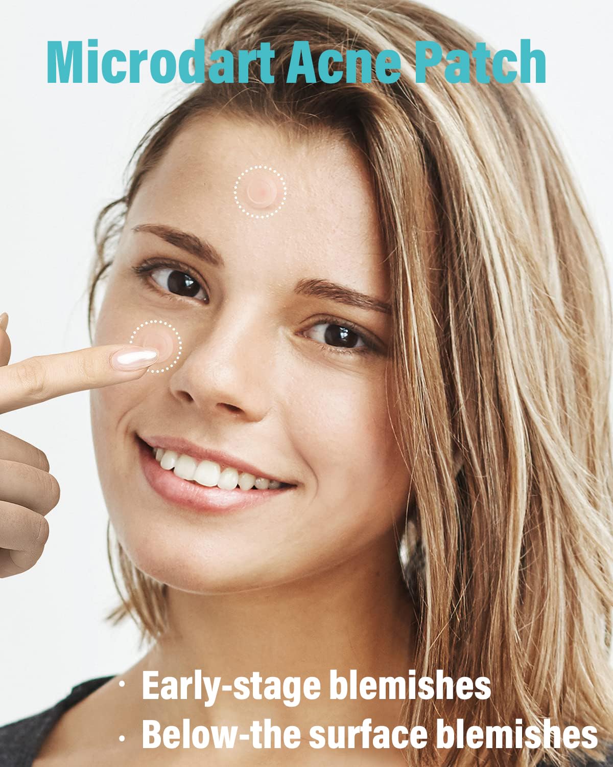 Microdart Acne Patch (27 Patches) - Hyaluronate Acid & Salicylic Acid Hydrocolloid Pimple Patch for Deep, Early and Hidden Blemishes (27 Count (Pack of 1))