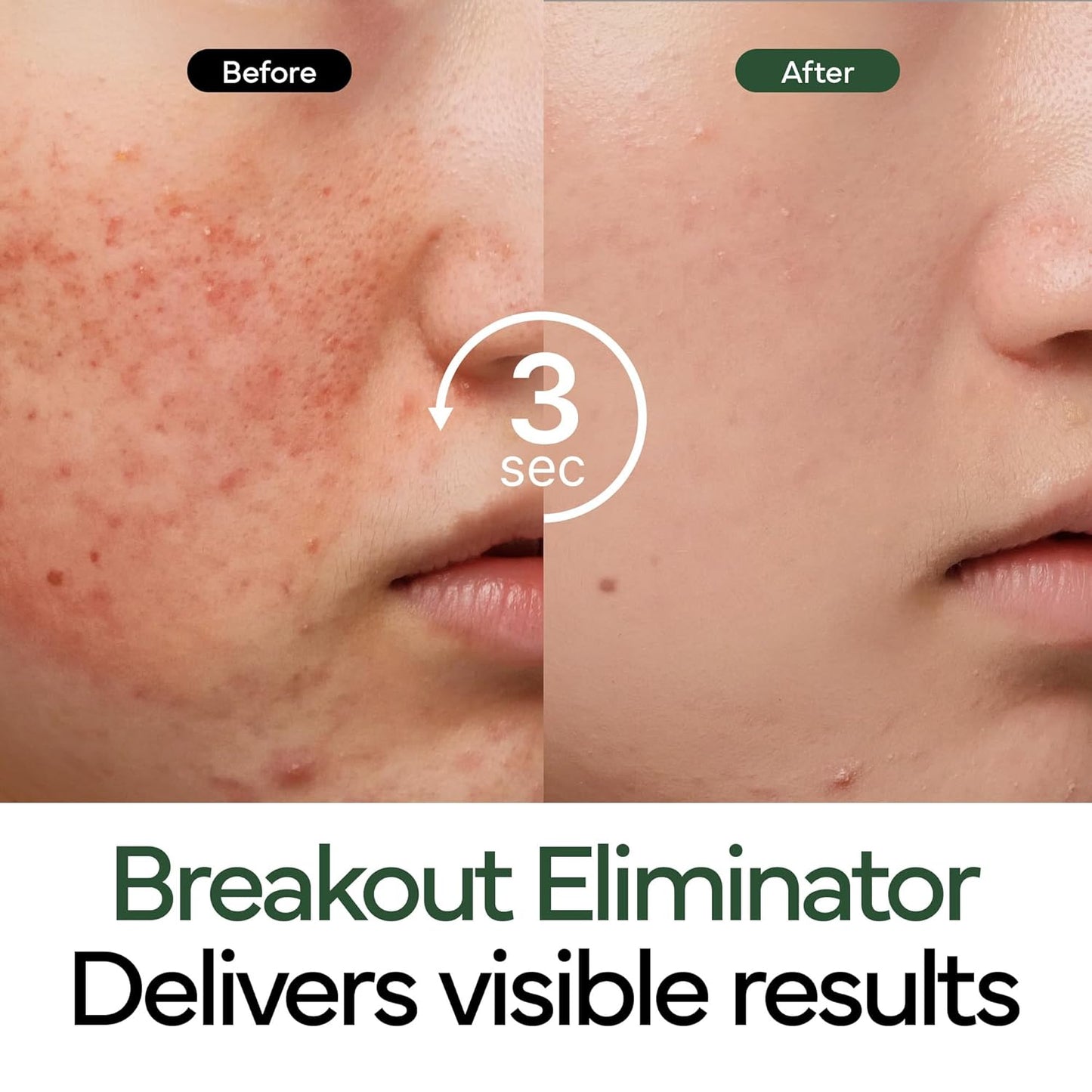 Intensive Cica Repair Cream, Korean Dexpanthenol cream, Ultra-Soothing & Hydrating Care Cream for Sensitive Skin with Madecassoside (1.76oz / 50g)