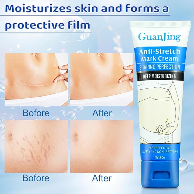 Stretch Mark Cream Stretch Mark Oil for Pregnancy, Stretch Mark Removal Belly Butter for Pregnant Women To Prevent And Repair Maternity Stretch Marks Scar Cream 2.82 Oz Skincare Body Oil 4.2 Fl.oz