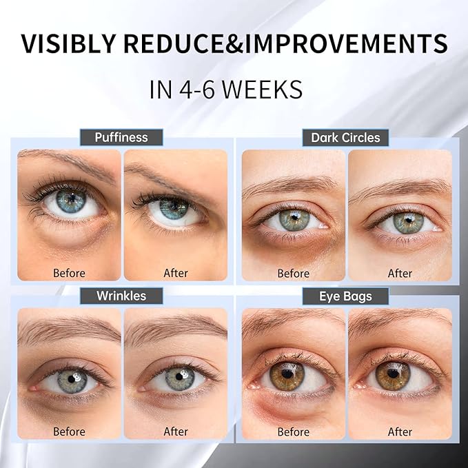 Advanced Snail Hydrogel Eye Patch 60 Patches, Gel Serum Mask, Undereye Treament, Fine Lined, Puffy Eyes, Refresh, Hydrate, Paraben free, Phthalates free, Skincare