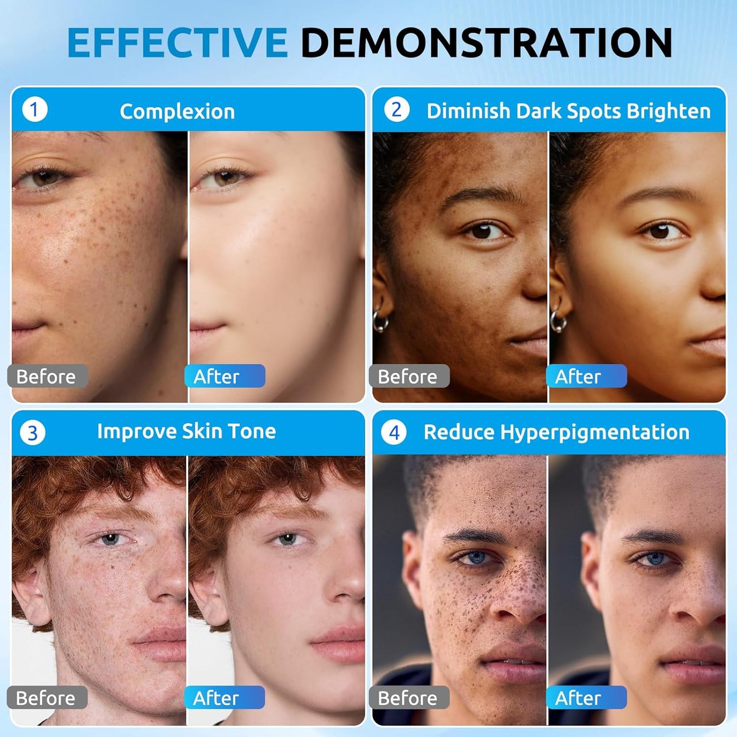 HANYWIL Dark Spot Remover for Face & Body Serum, Dark Spot Corrector Cream for Face & Body, Rapid Fade Treatment for Sun Spots, Age Spots, Melasma, Dermatologist-Tested Skin Tone Evenser(2.0 Fl Oz)