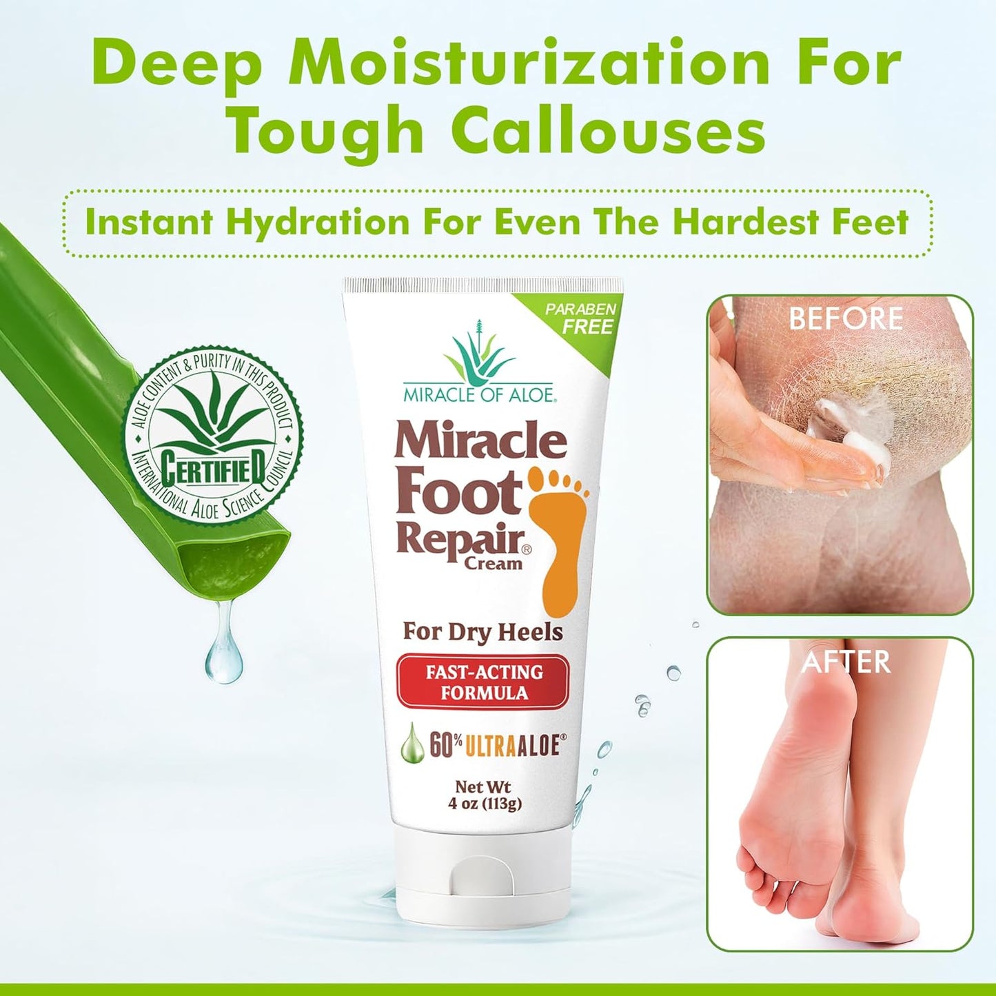 Aloe Vera Lotion & Foot Cream Combo – Aloe All Over 1 oz + Foot Repair 4 oz – Soothing Aloe Lotion for Dry Skin, Hands, Heels & Body – Diabetic-Safe Foot Cream for Cracked Feet