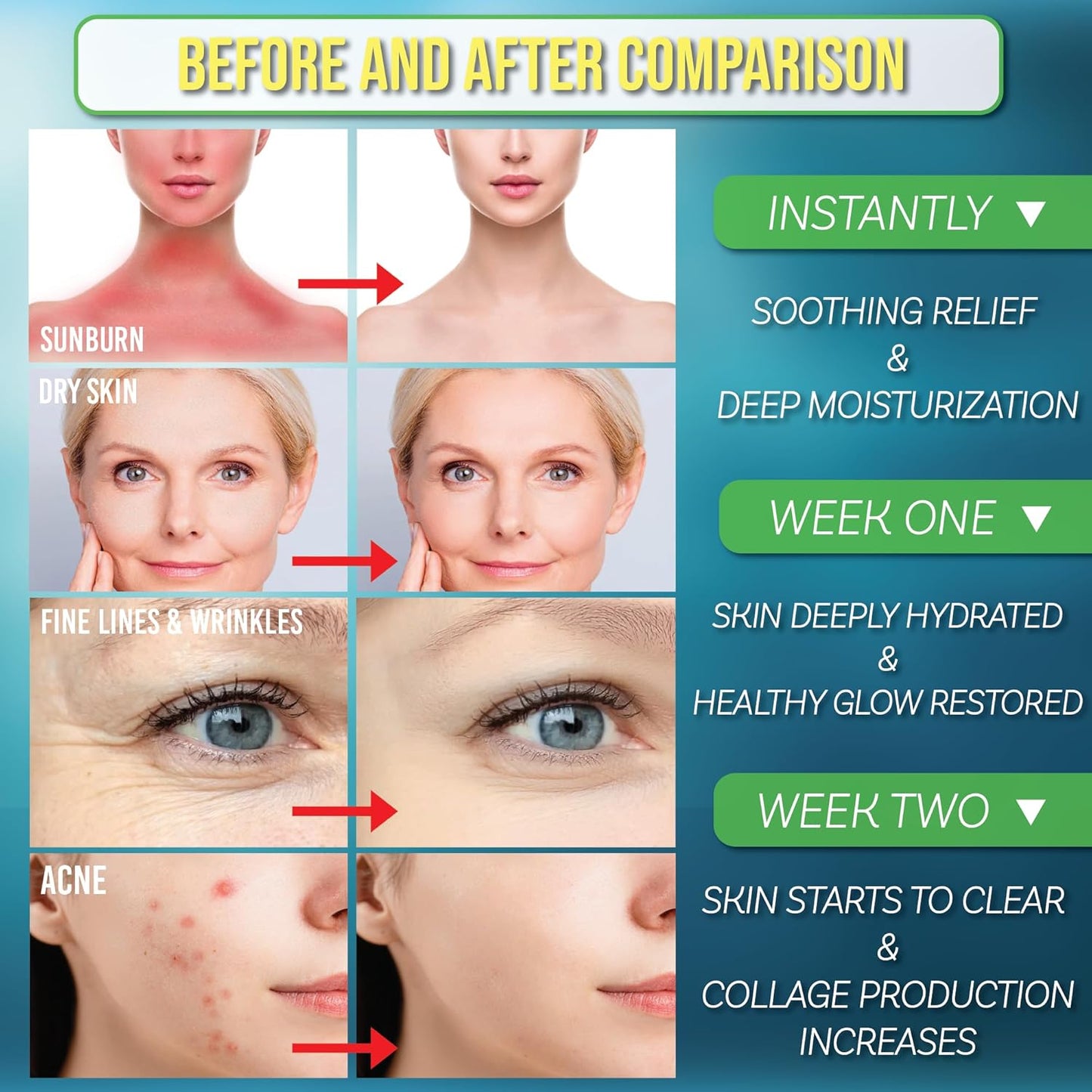 Green Leaf Naturals Aloe Vera Spray | 99% Cold-Pressed Aloe Vera Juice with Vitamin C, E & A | Hair, Skin, Facial Moisturizer, Sunburn Relief & After Sun Lotion 8oz