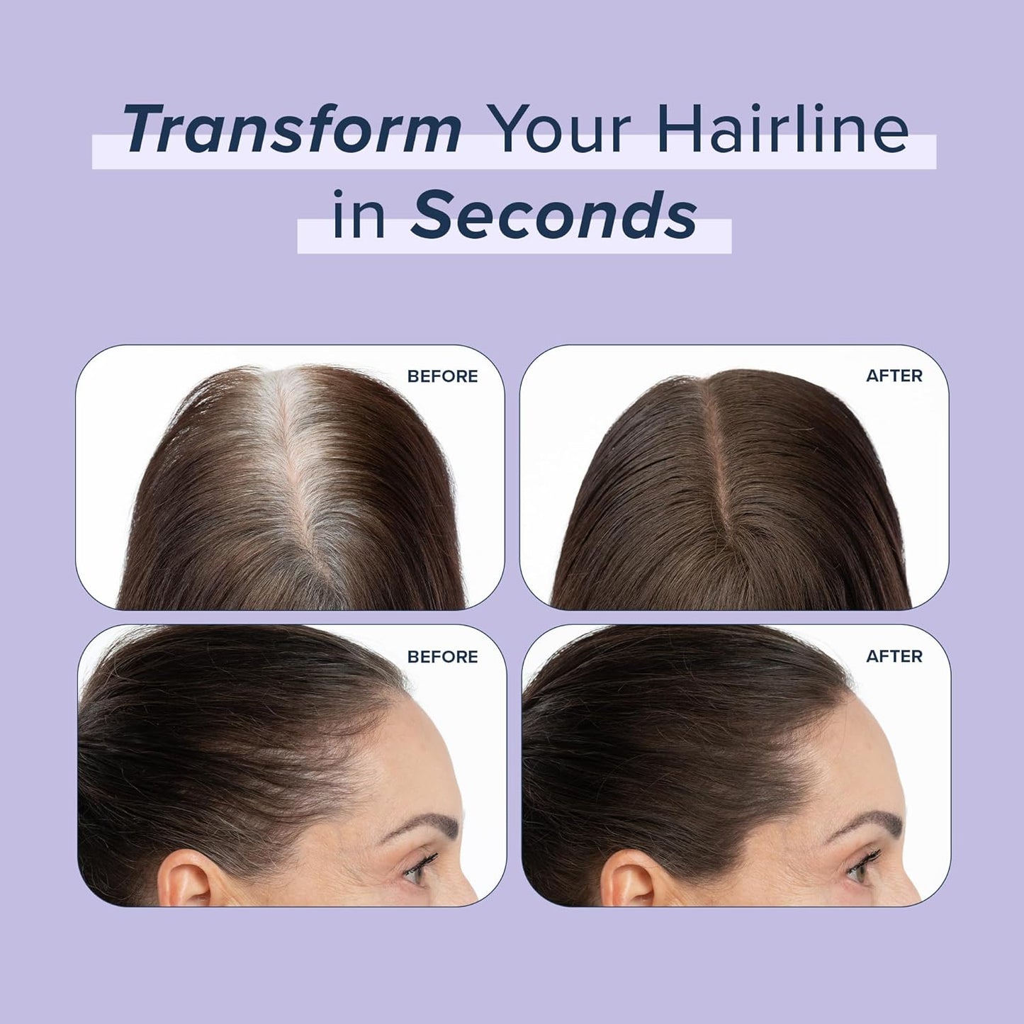 TRUHAIR Root & Scalp Cover Up Refill, Waterproof Pressed Powder for Gray Coverage, Bald Spots & Thinning Hair, Root Touch Up Color, 0.35 oz (Light Blonde)