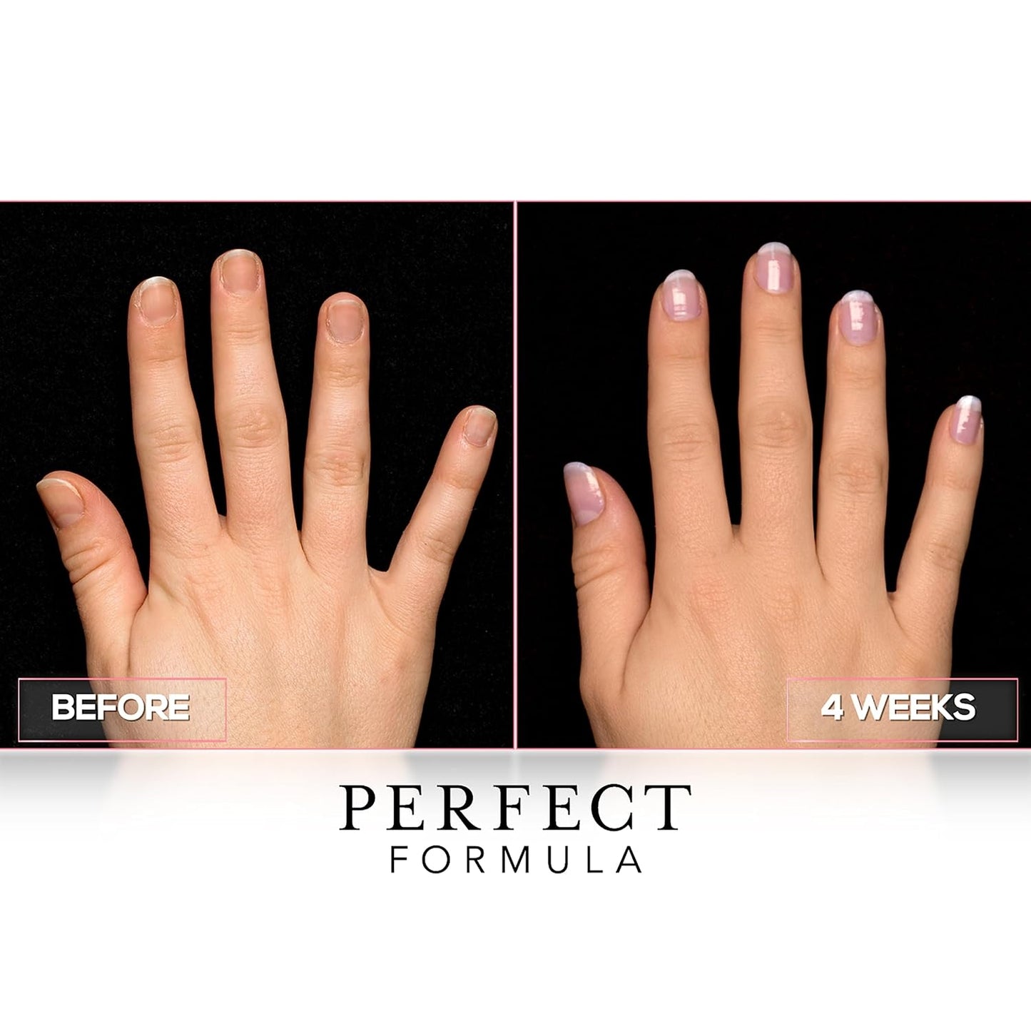 Perfect Formula Clear Gel Coat - Nail Strengthener, Keratin Treatment, Clear Nail Polish - Strengthener for Damaged Nails - Made In The USA .60 fl oz.